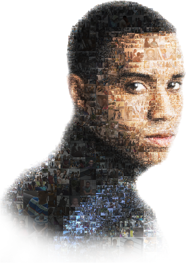 Mosaic picture of a Hemophilia A patient.